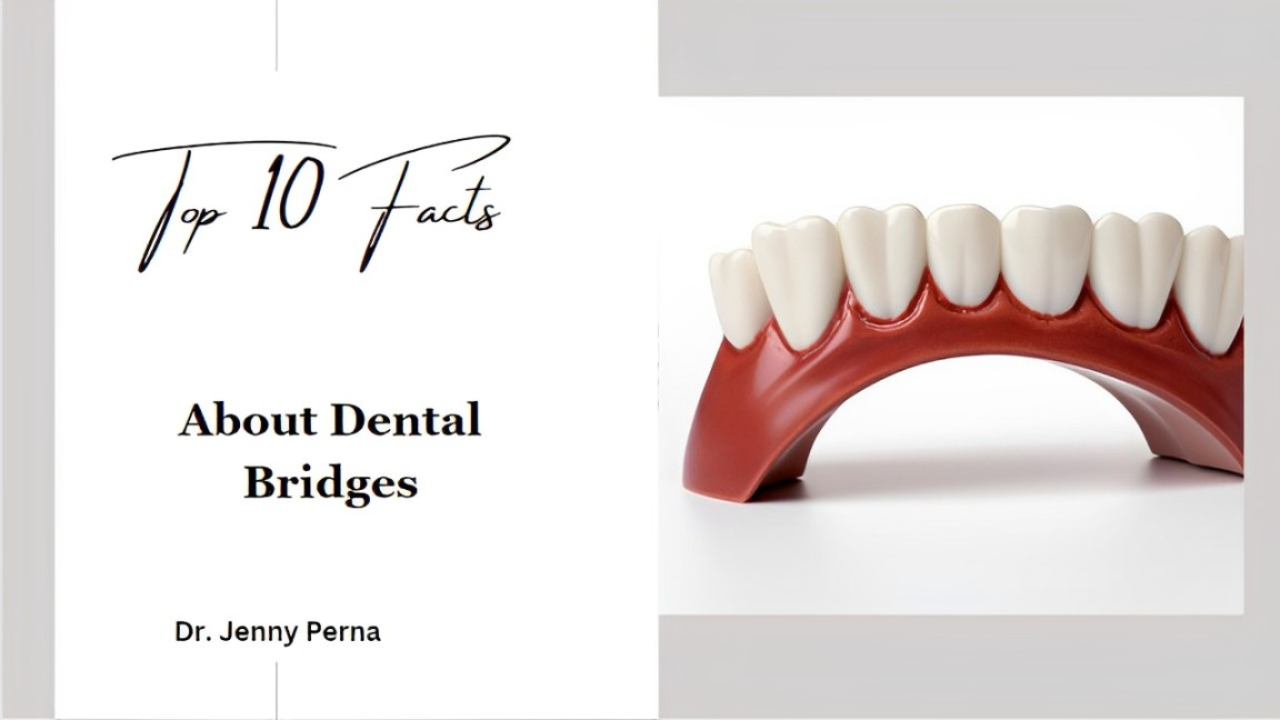 top 10 facts about dental bridges